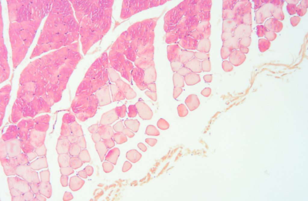 Angiogenesis Signaling pathway